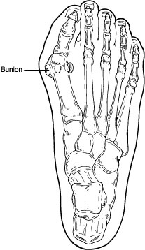 Patient discussing foot pain